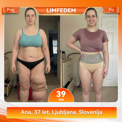Uradna trgovina blagovne znamke |👩‍⚕️𝑷𝑨𝑼𝑹𝑨𝑱𝑼® MORINGA & BERBERIN 4 V 1 MIKRO-DELČNO OBLIKOVANJE & KRATKE HLAČE ZA KURJENJE MAŠČOB🐽