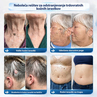 𝐏𝐢𝐜𝐝𝐨®🧑‍⚕️ 𝟕-𝐝𝐧𝐞𝐯𝐧𝐚 𝐤𝐫𝐞𝐦𝐚 𝐩𝐫𝐨𝐭𝐢 𝐤𝐨ž𝐧𝐢𝐦 𝐢𝐳𝐫𝐚𝐬𝐭𝐤𝐨𝐦 & 𝐩𝐢𝐠𝐦𝐞𝐧𝐭𝐧𝐢𝐦 𝐥𝐢𝐬𝐭𝐚𝐦𝐢 (Brezbolestna formula – brez brazgotin)💧