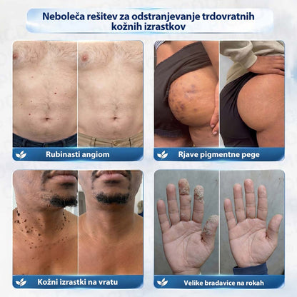 𝐏𝐢𝐜𝐝𝐨®🧑‍⚕️ 𝟕-𝐝𝐧𝐞𝐯𝐧𝐚 𝐤𝐫𝐞𝐦𝐚 𝐩𝐫𝐨𝐭𝐢 𝐤𝐨ž𝐧𝐢𝐦 𝐢𝐳𝐫𝐚𝐬𝐭𝐤𝐨𝐦 & 𝐩𝐢𝐠𝐦𝐞𝐧𝐭𝐧𝐢𝐦 𝐥𝐢𝐬𝐭𝐚𝐦𝐢 (Brezbolestna formula – brez brazgotin)💧