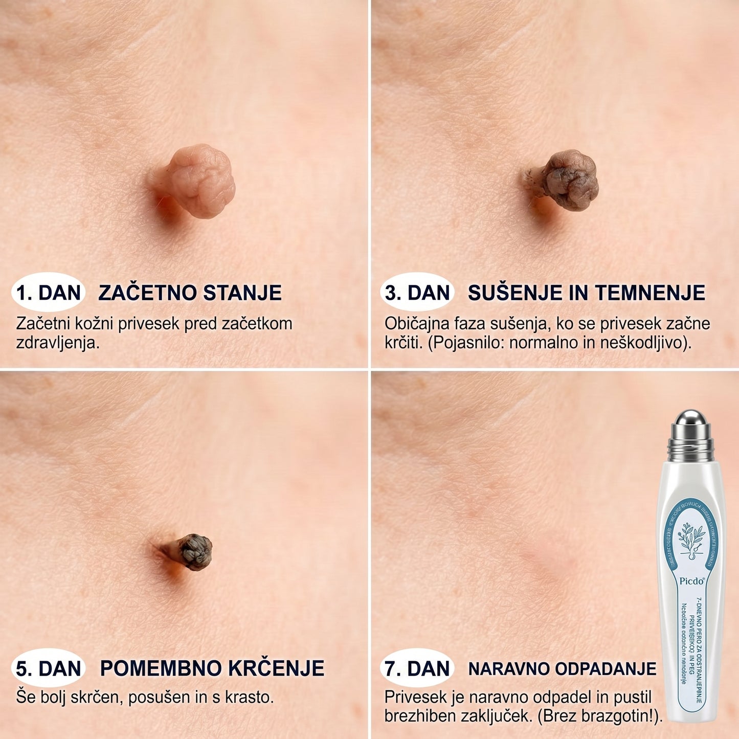 𝐏𝐢𝐜𝐝𝐨® 𝟕-𝐝𝐧𝐞𝐯𝐧𝐢 𝐨𝐝𝐬𝐭𝐫𝐚𝐧𝐣𝐞𝐯𝐚𝐥𝐞𝐜 𝐤𝐨ž𝐧𝐢𝐡 𝐢𝐳𝐫𝐚𝐬𝐭𝐤𝐨𝐯 𝐢𝐧 𝐦𝐚𝐝𝐞ž𝐞𝐯 (𝐫𝐨𝐥𝐥-𝐨𝐧 𝐚𝐩𝐥𝐢𝐤𝐚𝐭𝐨𝐫: 𝐛𝐫𝐞𝐳 𝐛𝐨𝐥𝐞č𝐢𝐧 𝐢𝐧 𝐛𝐫𝐚𝐳𝐠𝐨𝐭𝐢𝐧)💟