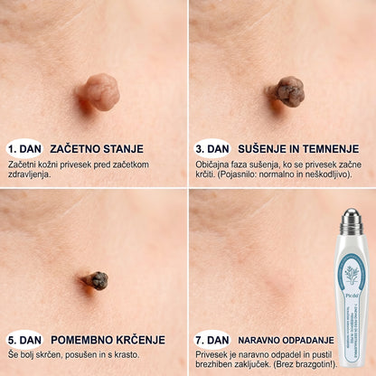 𝐏𝐢𝐜𝐝𝐨® 𝟕-𝐝𝐧𝐞𝐯𝐧𝐢 𝐨𝐝𝐬𝐭𝐫𝐚𝐧𝐣𝐞𝐯𝐚𝐥𝐞𝐜 𝐤𝐨ž𝐧𝐢𝐡 𝐢𝐳𝐫𝐚𝐬𝐭𝐤𝐨𝐯 𝐢𝐧 𝐦𝐚𝐝𝐞ž𝐞𝐯 (𝐫𝐨𝐥𝐥-𝐨𝐧 𝐚𝐩𝐥𝐢𝐤𝐚𝐭𝐨𝐫: 𝐛𝐫𝐞𝐳 𝐛𝐨𝐥𝐞č𝐢𝐧 𝐢𝐧 𝐛𝐫𝐚𝐳𝐠𝐨𝐭𝐢𝐧)💟