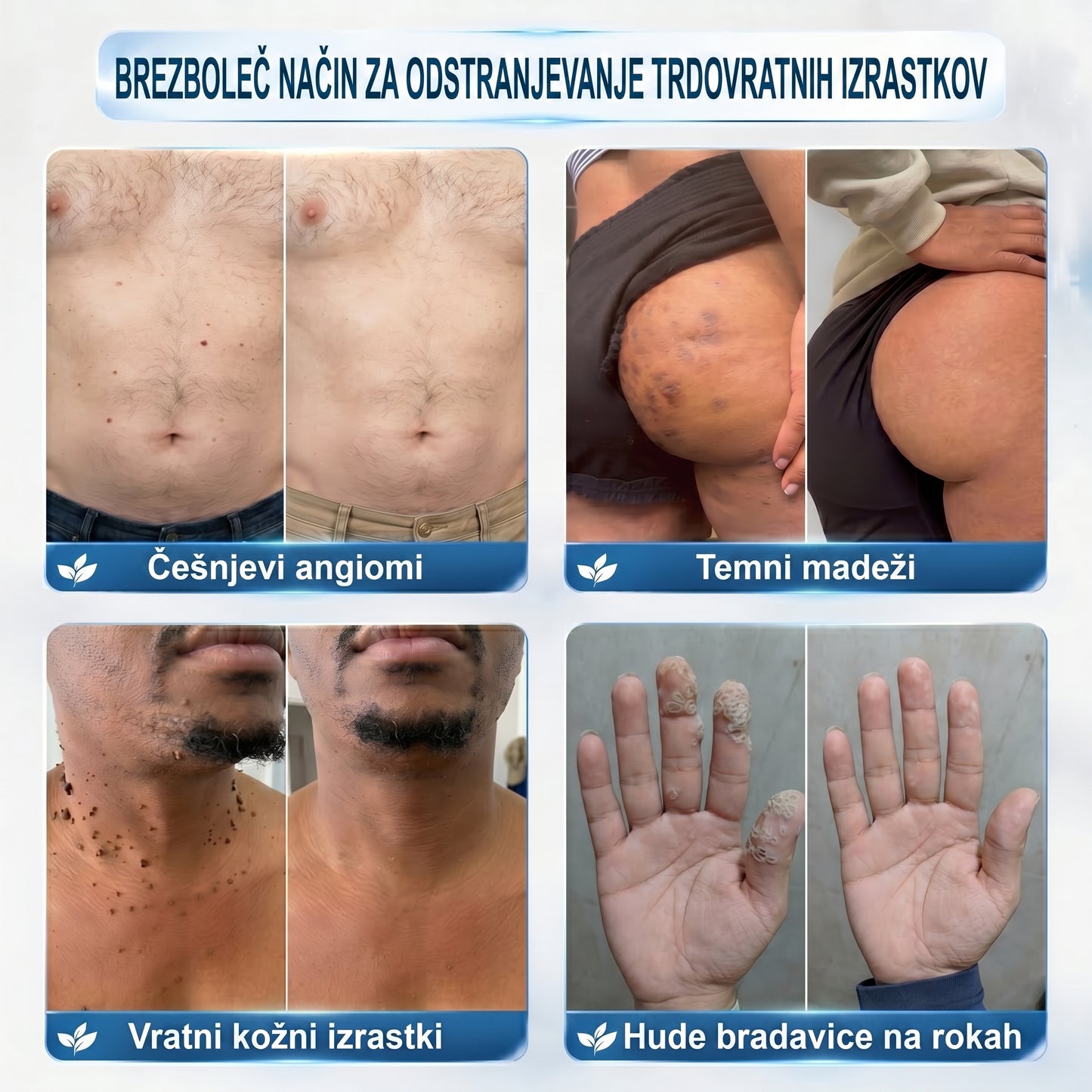 𝐏𝐢𝐜𝐝𝐨® 𝟕-𝐝𝐧𝐞𝐯𝐧𝐢 𝐨𝐝𝐬𝐭𝐫𝐚𝐧𝐣𝐞𝐯𝐚𝐥𝐞𝐜 𝐤𝐨ž𝐧𝐢𝐡 𝐢𝐳𝐫𝐚𝐬𝐭𝐤𝐨𝐯 𝐢𝐧 𝐦𝐚𝐝𝐞ž𝐞𝐯 (𝐫𝐨𝐥𝐥-𝐨𝐧 𝐚𝐩𝐥𝐢𝐤𝐚𝐭𝐨𝐫: 𝐛𝐫𝐞𝐳 𝐛𝐨𝐥𝐞č𝐢𝐧 𝐢𝐧 𝐛𝐫𝐚𝐳𝐠𝐨𝐭𝐢𝐧)💟